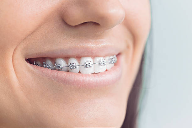 Best Invisalign and Clear Aligners  in Du Quoin, IL